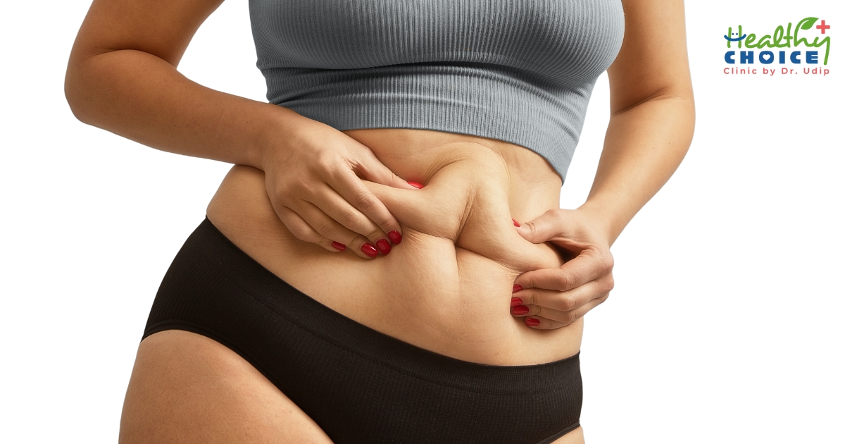 Get To Know About Excess Fat