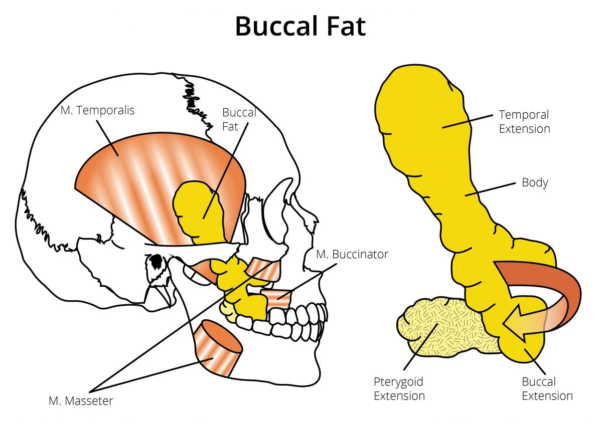 https://healthychoicenepal.com/wp-content/uploads/2023/06/Anatomy-of-Buccal-Fat-Pad-1200x844-1.jpg