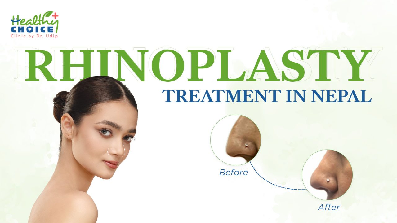 Best Rhinoplasty Treatment in Kathmandu Nepal