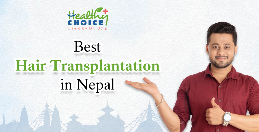 Best Hair Transplantation in Nepal