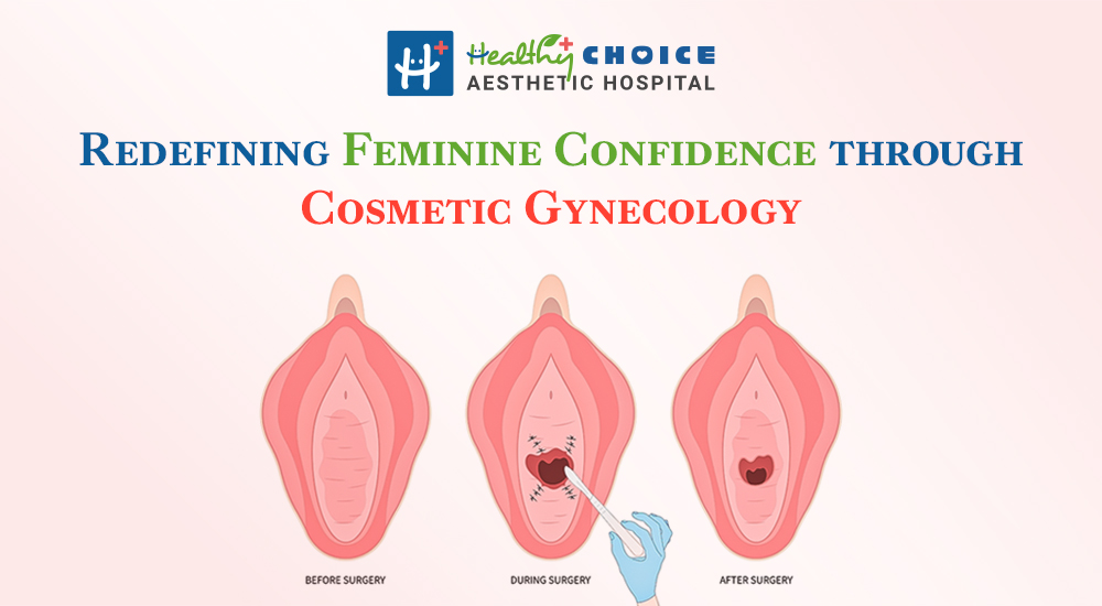 what is cosmetic gynecology