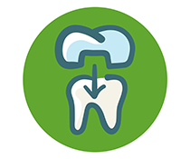 Crown: Dental Treatment