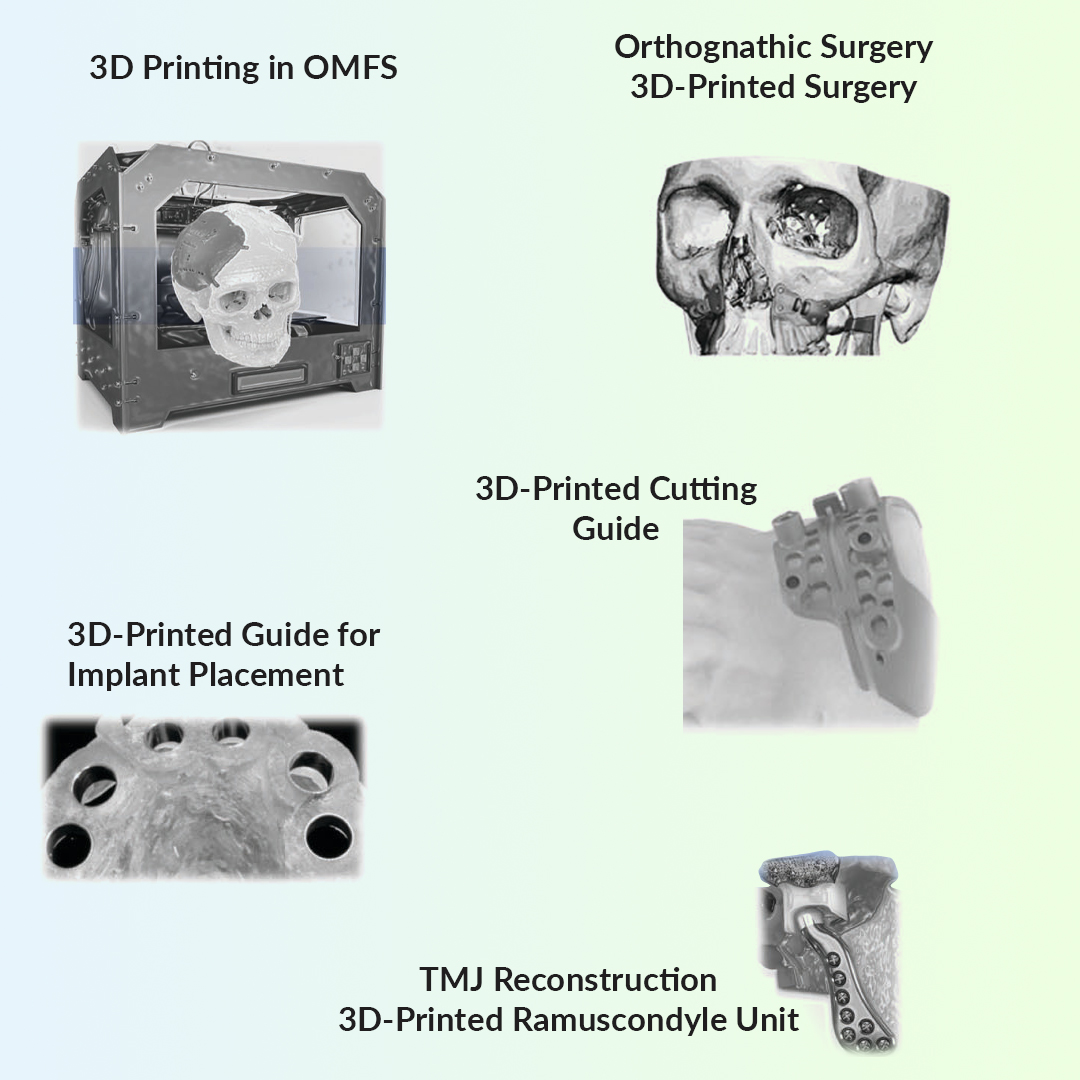 VSP and 3D printing in Oral & Maxillofacial Surgery