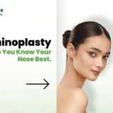 Rhinoplasty in Nepal