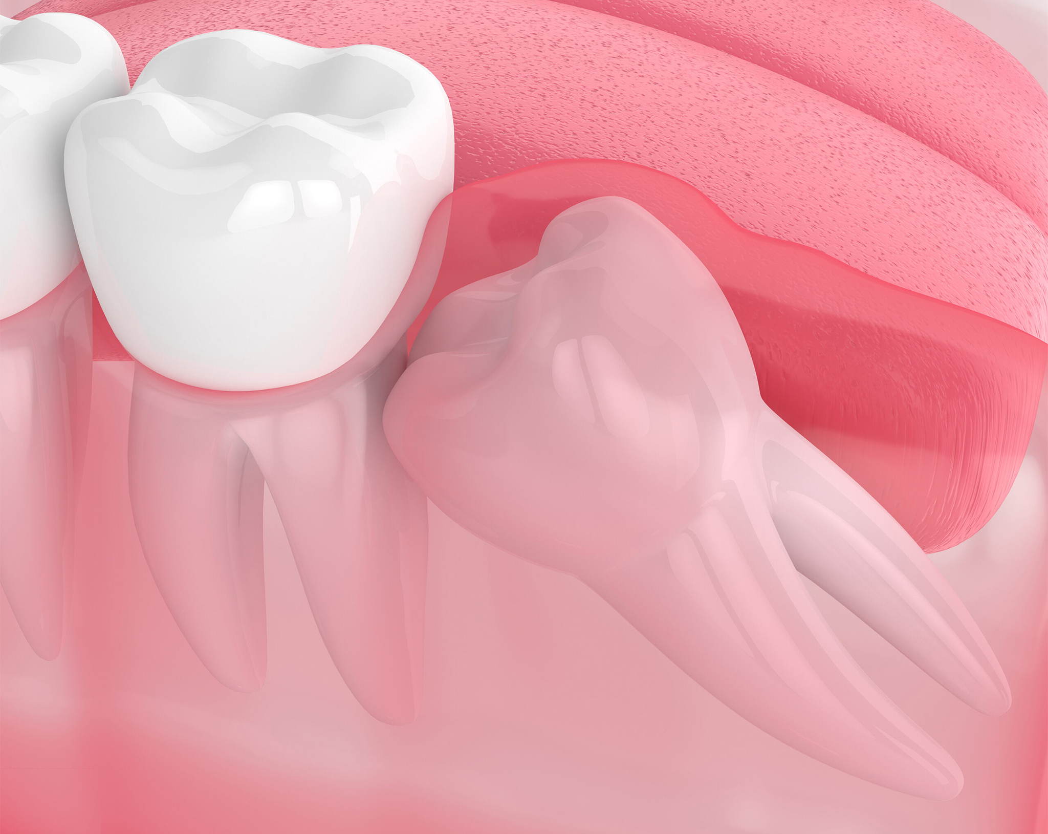 https://healthychoicenepal.com/wp-content/uploads/2025/11/Causes-of-Tooth-Impaction-copy-1.jpg