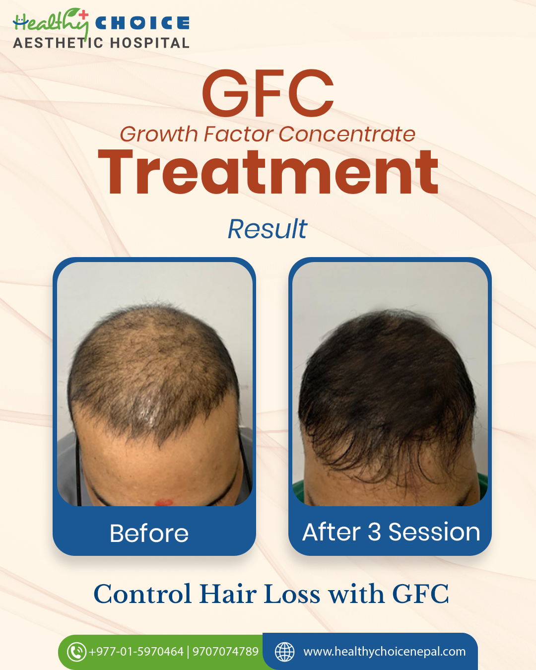 https://healthychoicenepal.com/wp-content/uploads/2025/12/574948053_824804360314851_1816450250882873192_n.jpg