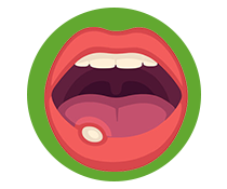 Aphthous Ulcer https://healthychoicenepal.com/wp-content/uploads/2025/12/Aphthous-Ulcer.png