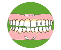 Cervical Abrasion https://healthychoicenepal.com/wp-content/uploads/2025/12/Cervical-Abrasion.png