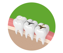 Tooth Filing https://healthychoicenepal.com/wp-content/uploads/2025/12/Tooth-Filing.png