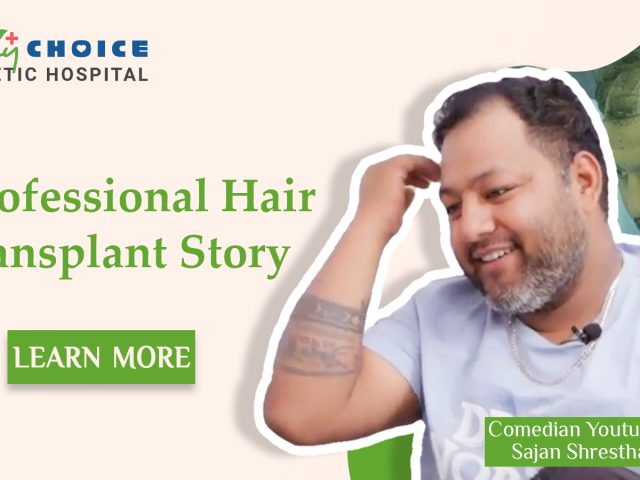 Sajan Sherestha’s Hair Transformation: A Professional Hair Transplant Journey Sajan Sherestha’s Hair Transformation: A Professional Hair Transplant Journey
