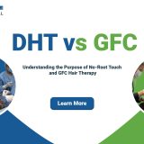 DHT vs GFC Hair Therapy: