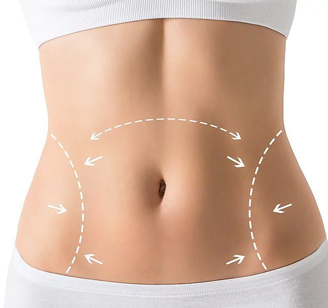https://healthychoicenepal.com/wp-content/uploads/2026/06/Cryolipolysis.webp