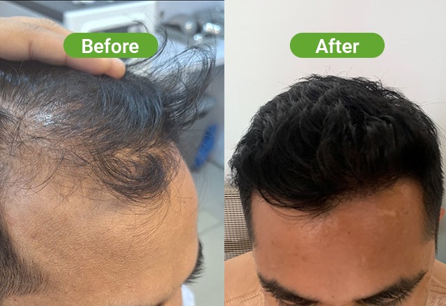 https://healthychoicenepal.com/wp-content/uploads/2026/06/WhatsApp-Image-2026-06-07-at-12.27.26.jpeg