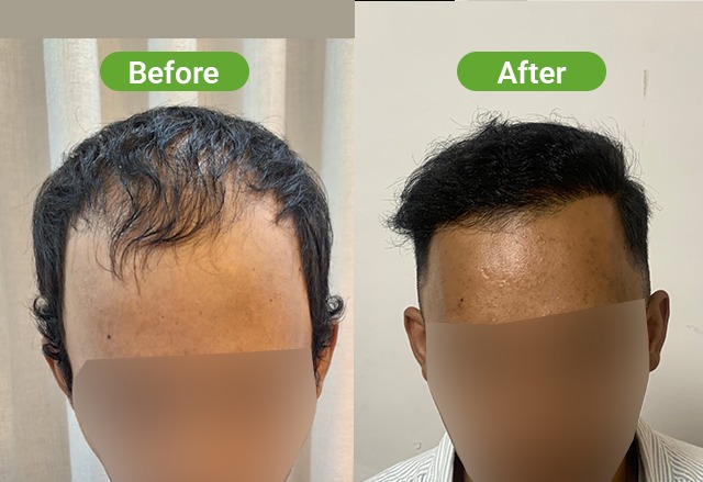 https://healthychoicenepal.com/wp-content/uploads/2026/06/WhatsApp-Image-2026-06-07-at-12.27.27.jpeg