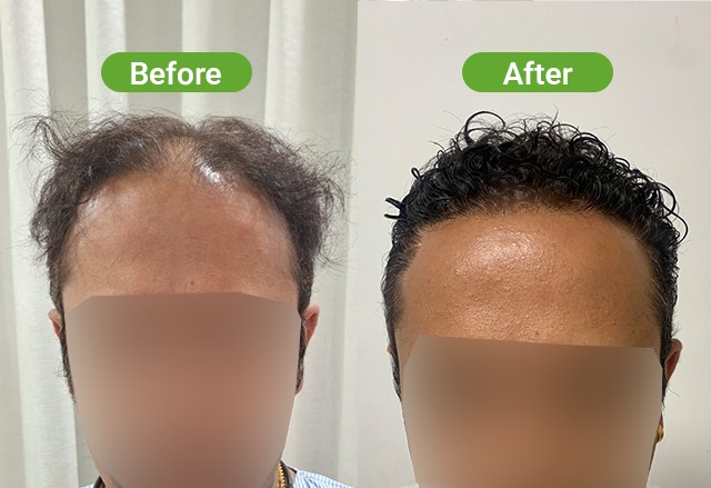 https://healthychoicenepal.com/wp-content/uploads/2026/06/WhatsApp-Image-2026-06-07-at-12.27.28.jpeg