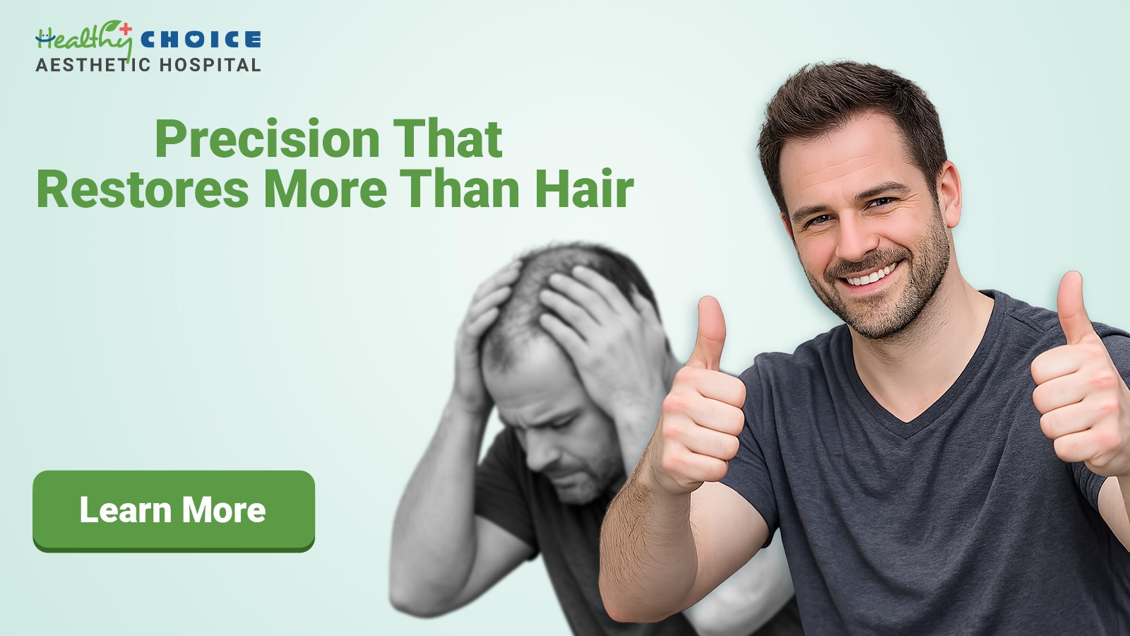 Hair Transplant