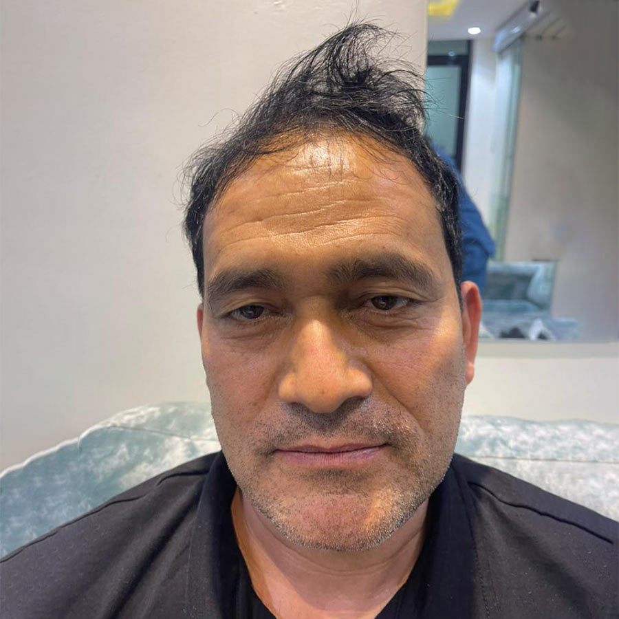 <span class="bt_bb_before_after_image_before_text">Before</span>