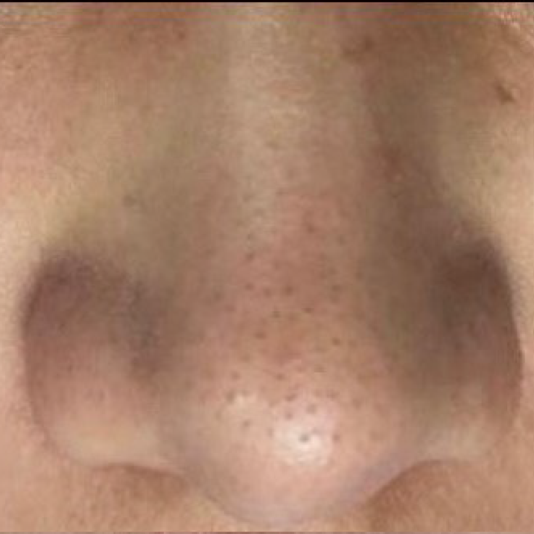 <span class="bt_bb_before_after_image_before_text">Before</span>