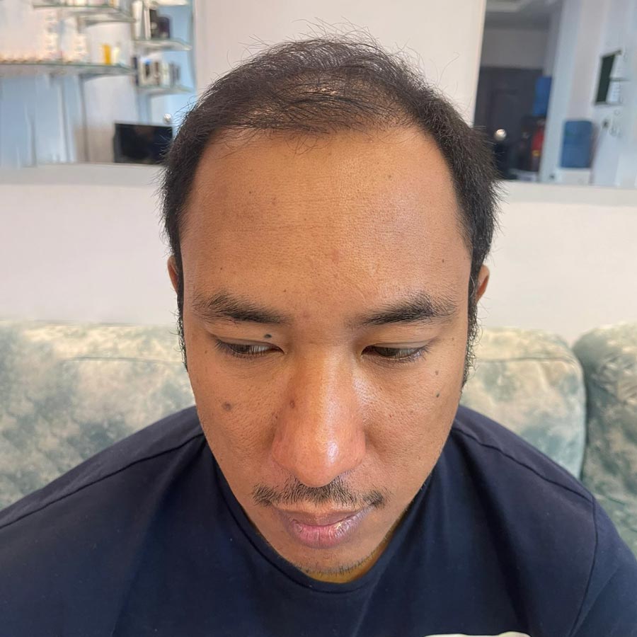 <span class="bt_bb_before_after_image_before_text">Before</span>
