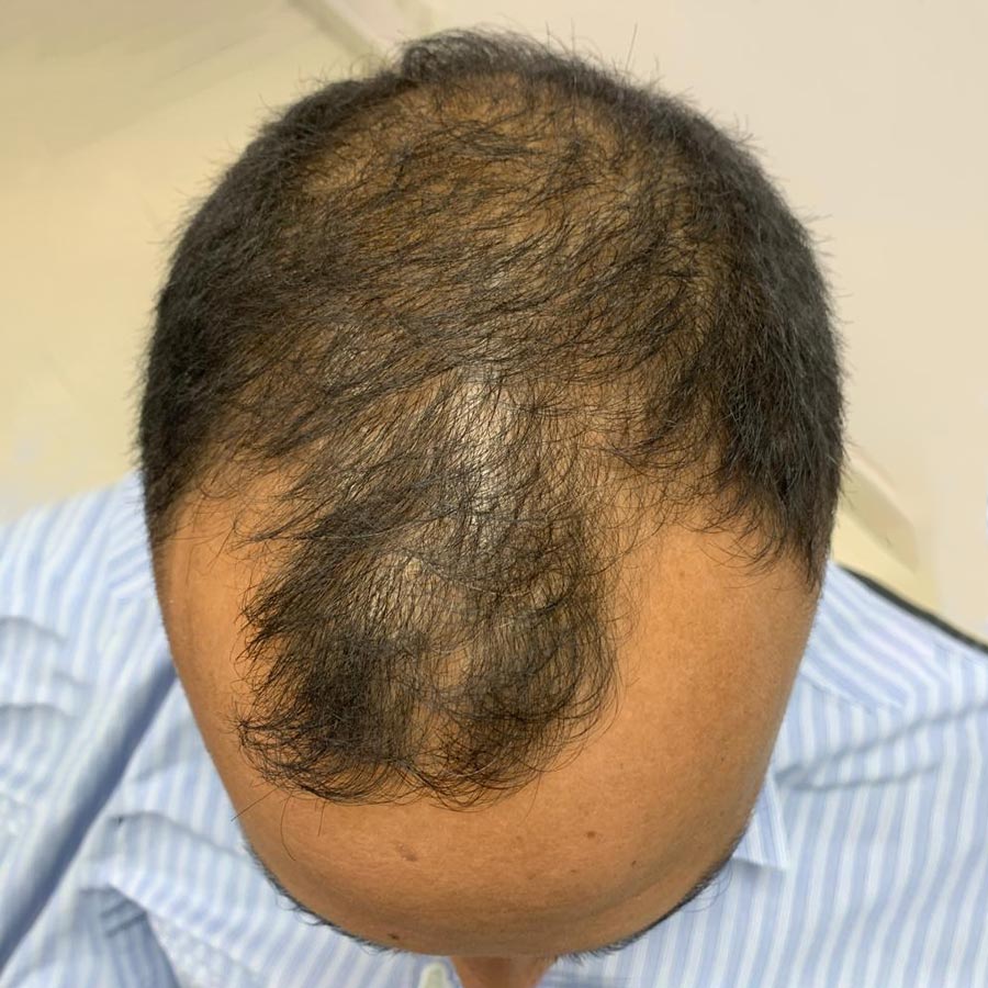 <span class="bt_bb_before_after_image_before_text">Before</span>