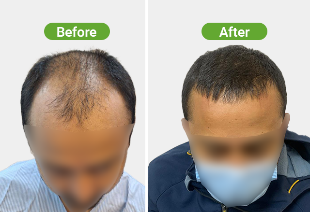 https://healthychoicenepal.com/wp-content/uploads/2026/07/Website-1-4500-12-months.png