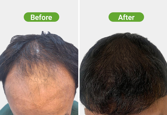 https://healthychoicenepal.com/wp-content/uploads/2026/07/Website-2-2535-12-months.png