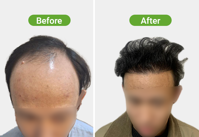 https://healthychoicenepal.com/wp-content/uploads/2026/07/Website-3-4000-12-months.png