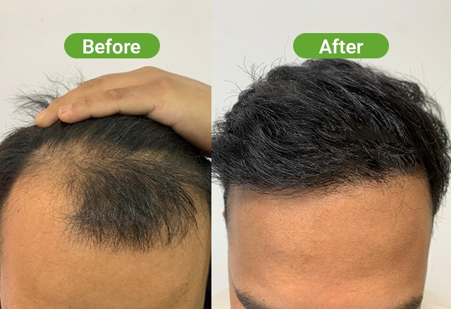 https://healthychoicenepal.com/wp-content/uploads/2026/07/WhatsApp-Image-2026-07-02-at-12.40.42.jpeg