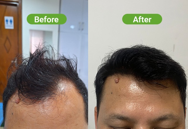 https://healthychoicenepal.com/wp-content/uploads/2026/07/WhatsApp-Image-2026-07-02-at-12.40.43.jpeg