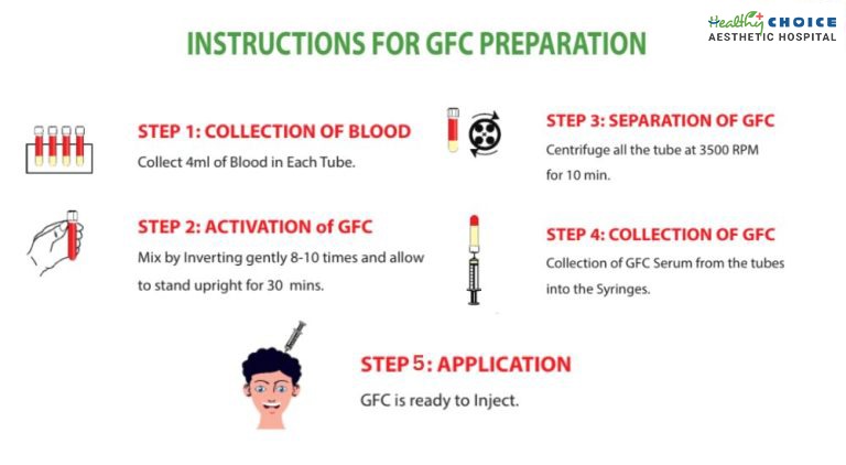 Gfc preparation