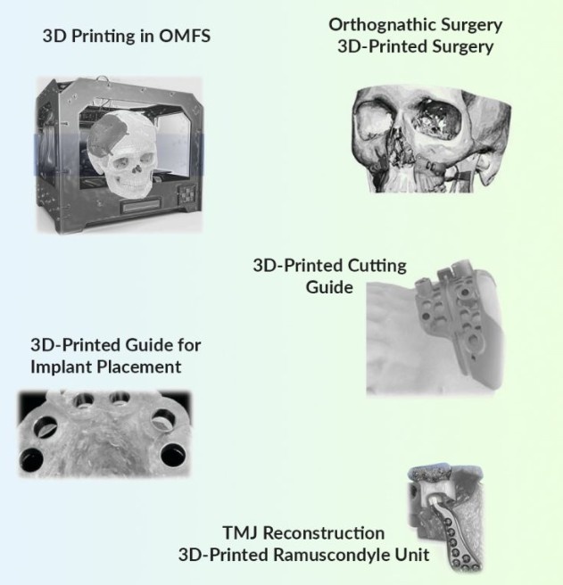 VSP & 3D Printing