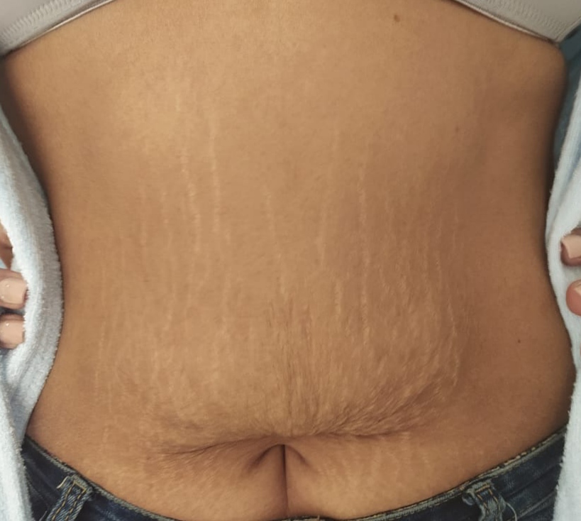 <span class="bt_bb_before_after_image_before_text">Before</span>