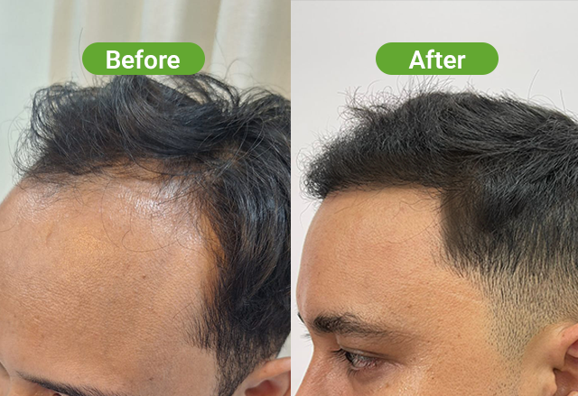 https://healthychoicenepal.com/wp-content/uploads/2026/08/8-MONTHS-2500-WEBSITE.png