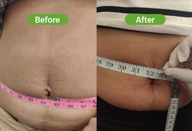 PowerShape 2 before and after