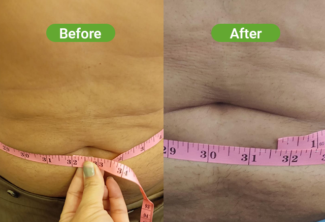 PowerShape 2 before and after