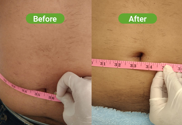 PowerShape 2 before and after