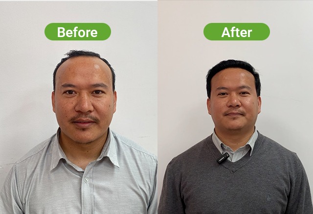 https://healthychoicenepal.com/wp-content/uploads/2026/09/WhatsApp-Image-2026-09-30-at-13.45.22.jpeg